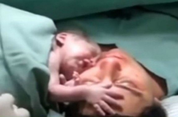 Εκπληκτικό βίντεο: Νεογέννητο μωράκι αρνείται να αποχωριστεί τη μαμά του!